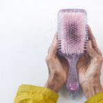 駅前AGAクリニックの円形脱毛症治療が凄まじい！